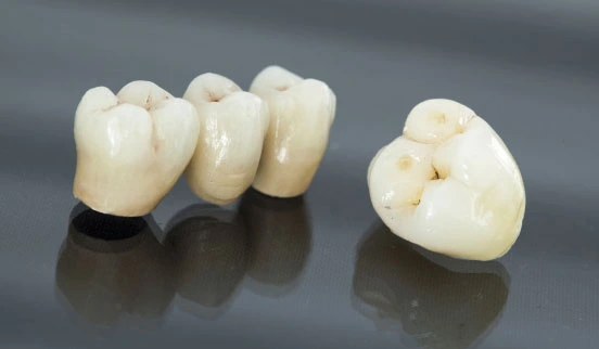 Teeth Restoration Treatment 